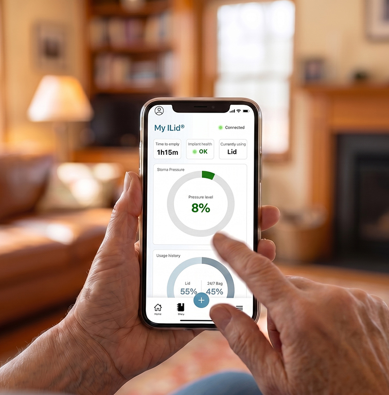 e-TIES Digital platform with app mockup and connected lid